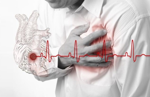 У трьох закладах Рівненщини можна отримати безоплатну медичну допомогу при інфаркті