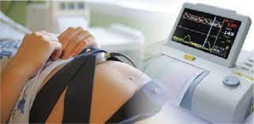 Рівненщина отримає 10 телеметричних кардіографів для вагітних